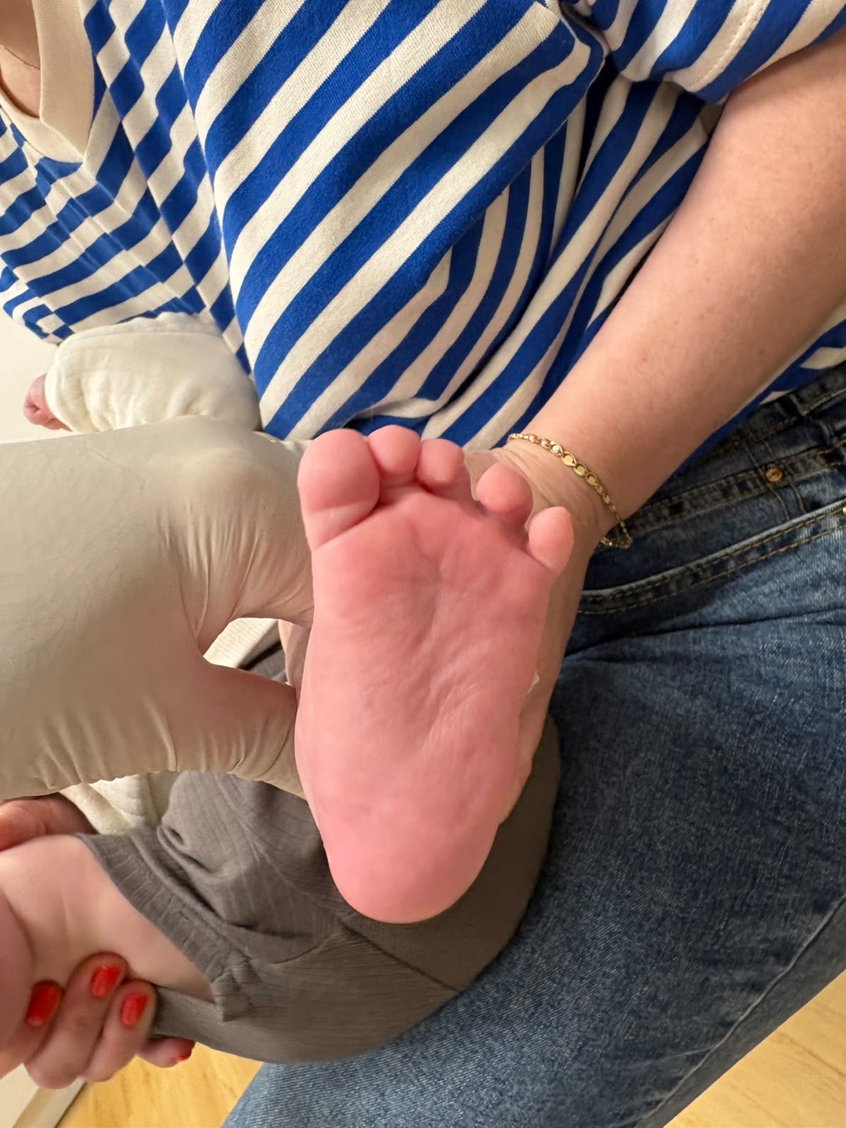 Sole view after treatment — normal, plantigrade foot